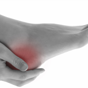 Managing MSK Conditions - Achilles Problems